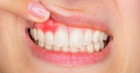 Clinica Dental Crooke Marbella