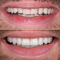 R&H Dental Marbella
