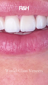 R&H Dental Marbella