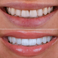 R&H Dental Marbella