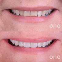Clínica Dental Øne Clinic Marbella