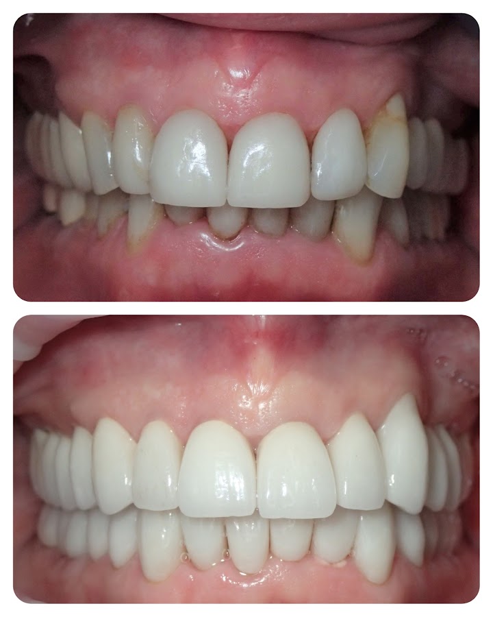 Dental Marbella - dental clinic in Marbella, Spain