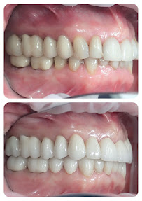 Dental Marbella