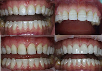 Dental Marbella