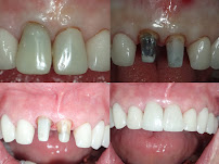 Dental Marbella