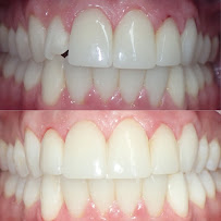Dental Marbella