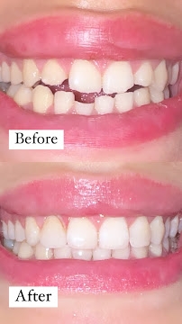Dental Marbella