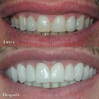 Dental Marbella