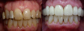 Dental Marbella