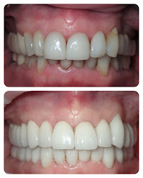 Dental Marbella in Marbella