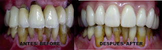 Dental Marbella