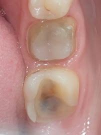 Dental Marbella