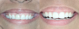 Dental Marbella