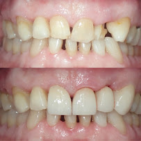 Dental Marbella