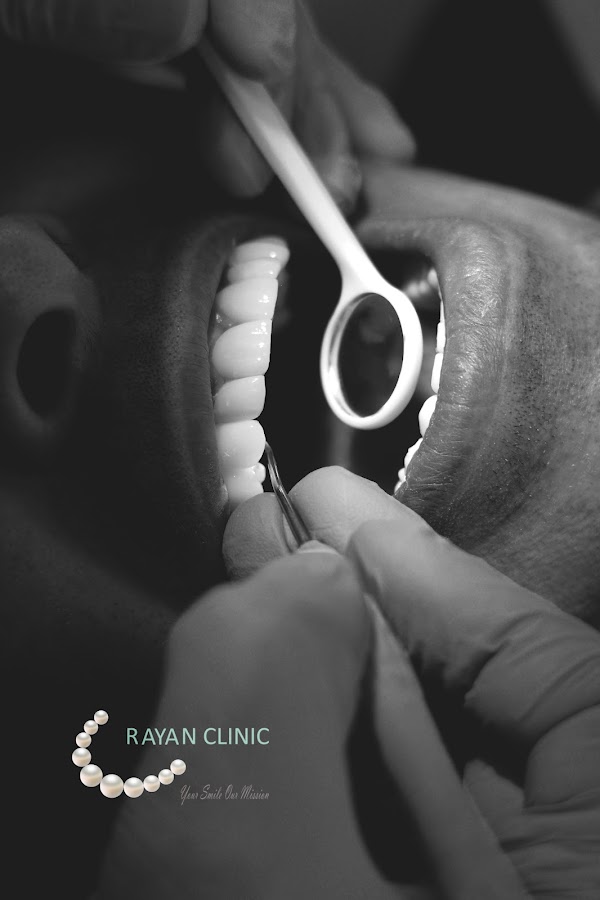 Rayan Clinic Marbella - dental clinic in Marbella, Spain