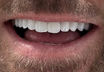 City Clinic Marbella | Dental Clinic and Aesthetic Medicine