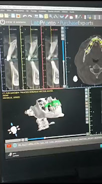 Rehabilitación Dental dentista Cancún endodoncia implantes prótesis fija