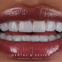 DENTAL & DESIGN GROUP - Expertos en Diseños de Sonrisa, Carillas Dentales - Marbella