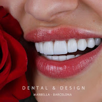 DENTAL & DESIGN GROUP - Expertos en Diseños de Sonrisa, Carillas Dentales - Marbella