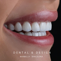 DENTAL & DESIGN GROUP - Expertos en Diseños de Sonrisa, Carillas Dentales - Marbella