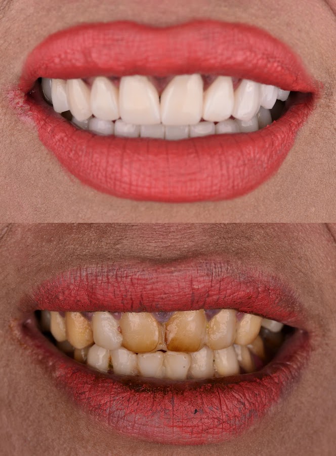 UNIQUE DENTAL CLINIC CANCUN MX - dental clinic in Cancun, Mexico