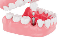 Boca Clinicas