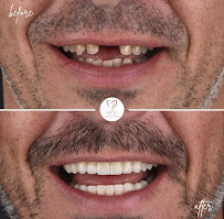 Focus Dental Clinic | Implant & Smile Design Center
