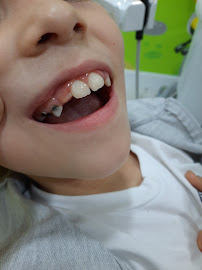 Mandarindent - Bodrum Diş Kliniği – Diş Tedavileri – Diş İmplantı – Estetik Diş Hekimliği