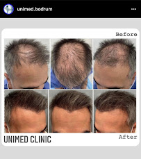 Unimed Clinic bodrum