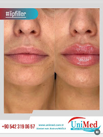 Unimed Clinic bodrum