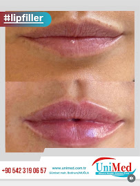 Unimed Clinic bodrum