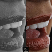 Diseño de sonrisa / Dental Experience / Blanqueamiento dental/ implantes Dentales