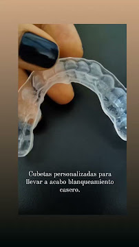 Diseño de sonrisa / Dental Experience / Blanqueamiento dental/ implantes Dentales