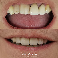 Maria Marin Dentist - English Speaking Dentist