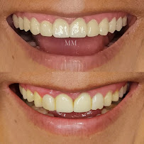 Maria Marin Dentist - English Speaking Dentist