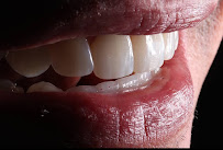 Doctora Veronica Diseño de Sonrisa en Bogotá Carillas de Porcelana Implantes Dentales Ortodoncia Invisalign
