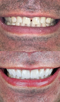 Doctora Veronica Diseño de Sonrisa en Bogotá Carillas de Porcelana Implantes Dentales Ortodoncia Invisalign
