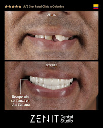 Zenit Dental Studio - Diseño de Sonrisa en Bogota
