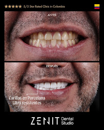 Zenit Dental Studio - Diseño de Sonrisa en Bogota