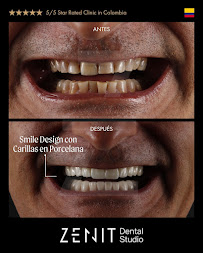 Zenit Dental Studio - Diseño de Sonrisa en Bogota