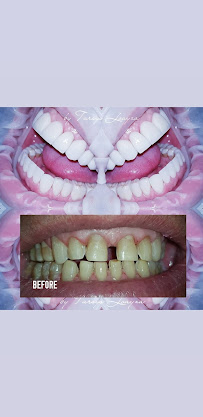 Sonrisa Perfecta Dental - Tarsys Loayza Roys