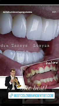 Sonrisa Perfecta Dental - Tarsys Loayza Roys