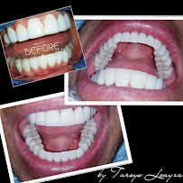 Sonrisa Perfecta Dental - Tarsys Loayza Roys