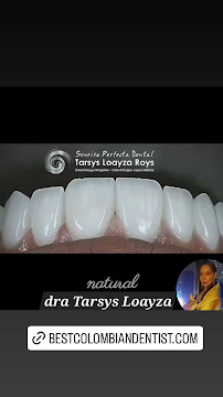 Sonrisa Perfecta Dental - Tarsys Loayza Roys in Cartagena De Indias, Colombia