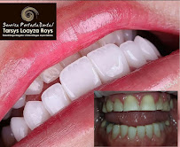 Sonrisa Perfecta Dental - Tarsys Loayza Roys