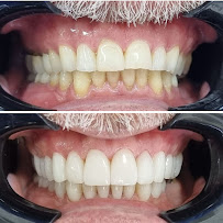 Dental Tourism Colombia (Cartagena, Dr. Julio Oliver)