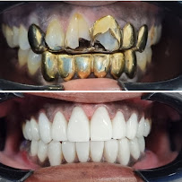 Dental Tourism Colombia (Cartagena, Dr. Julio Oliver)