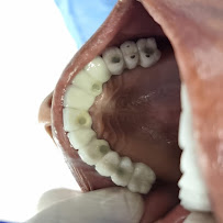 Dental Tourism Colombia (Cartagena, Dr. Julio Oliver)