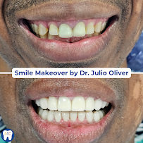 Dental Tourism Colombia (Cartagena, Dr. Julio Oliver)