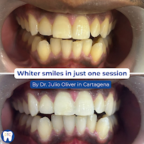 Dental Tourism Colombia (Cartagena, Dr. Julio Oliver)